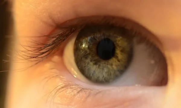 Oeil