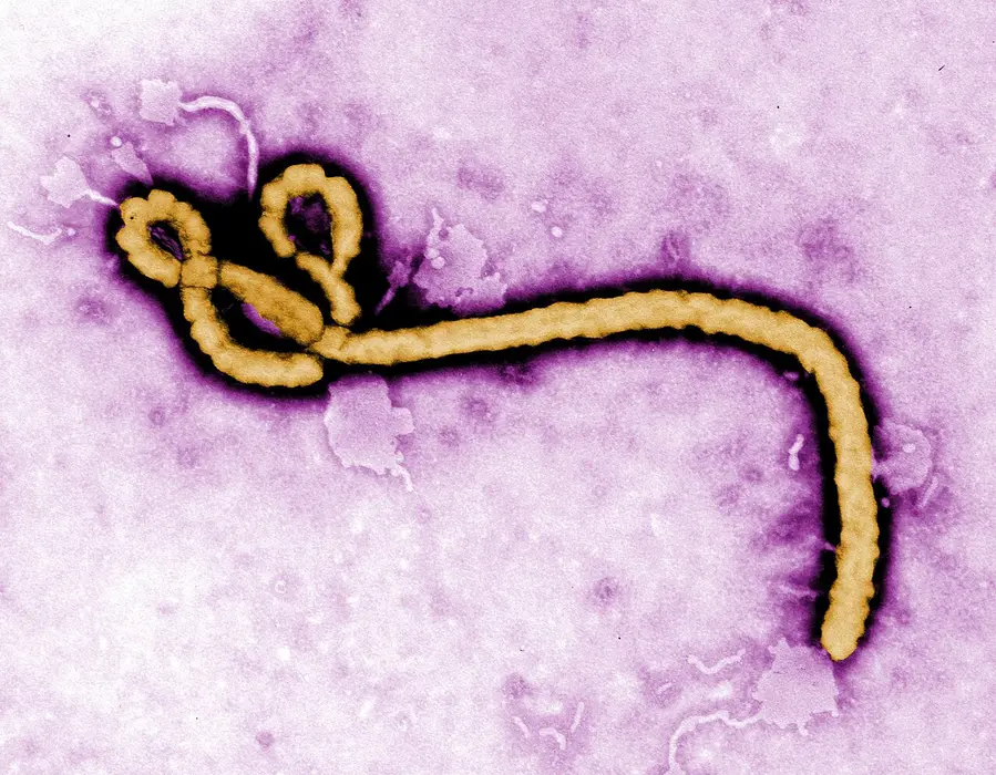 Ebola virus vu au microscope